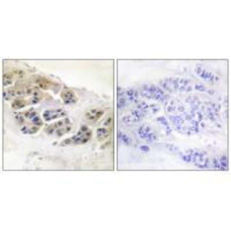 Immunohistochemistry - Mammaglobin Antibody from Signalway Antibody (33427) - Antibodies.com