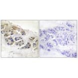 Immunohistochemistry - Mammaglobin Antibody from Signalway Antibody (33427) - Antibodies.com
