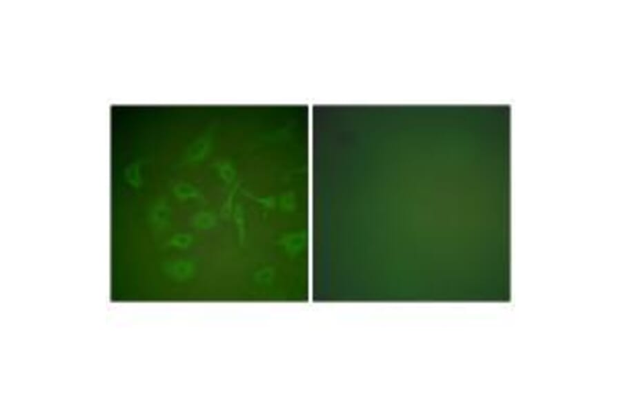 Immunofluorescence - Mammaglobin Antibody from Signalway Antibody (33427) - Antibodies.com