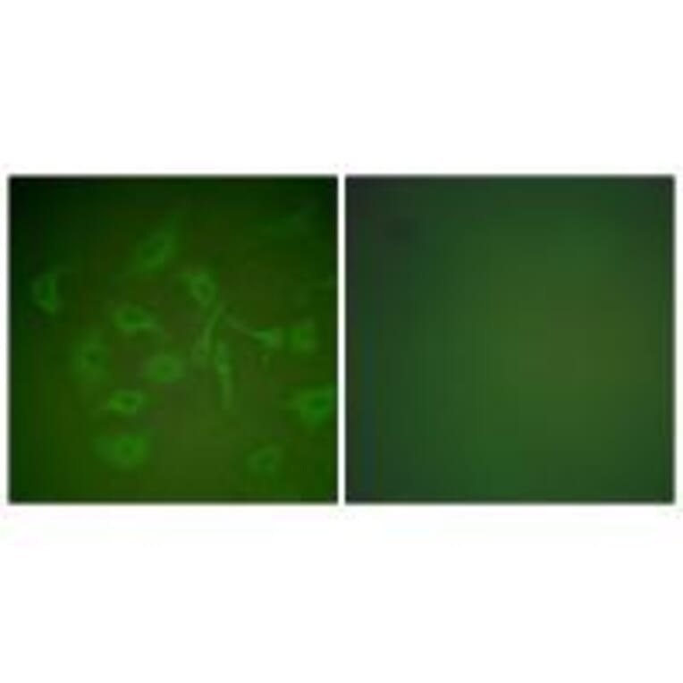 Immunofluorescence - Mammaglobin Antibody from Signalway Antibody (33427) - Antibodies.com