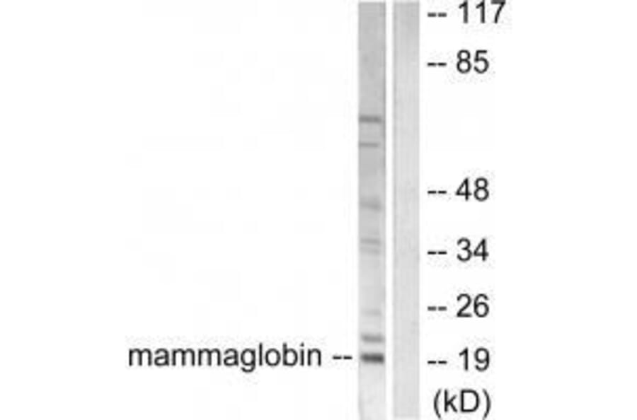 Western blot - Mammaglobin Antibody from Signalway Antibody (33427) - Antibodies.com