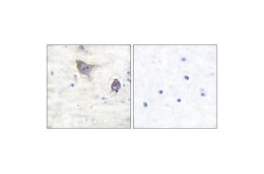 Immunohistochemistry - Synuclein β Antibody from Signalway Antibody (33494) - Antibodies.com