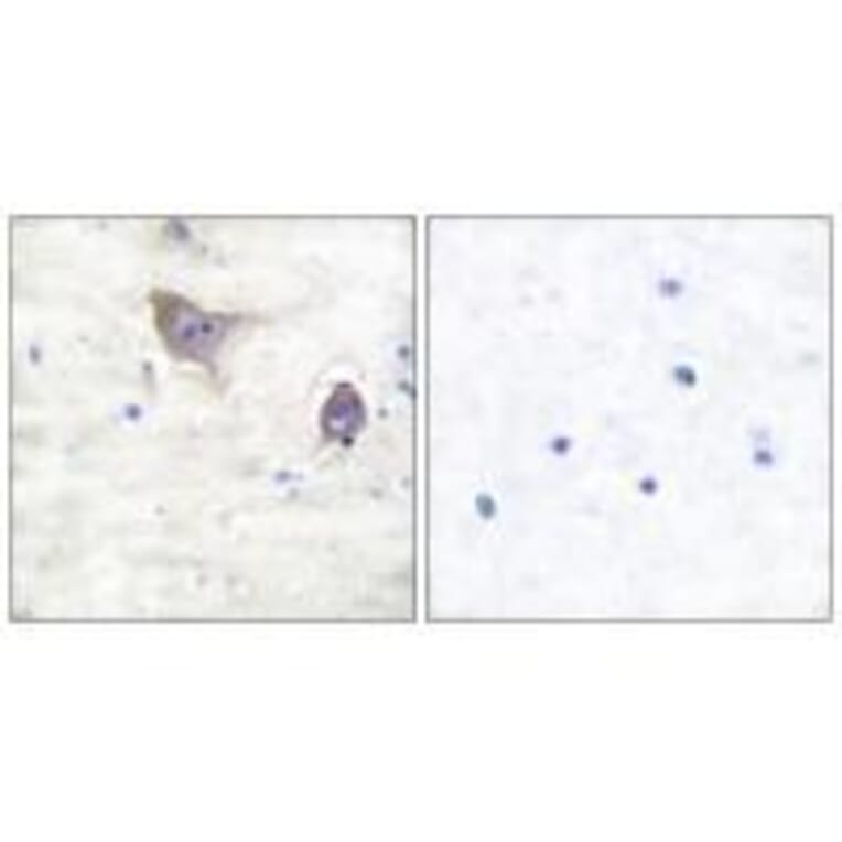 Immunohistochemistry - Synuclein β Antibody from Signalway Antibody (33494) - Antibodies.com