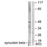 Western blot - Synuclein β Antibody from Signalway Antibody (33494) - Antibodies.com