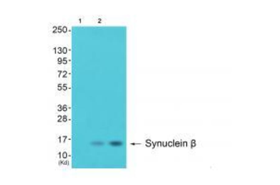 Western blot - Synuclein β Antibody from Signalway Antibody (33494) - Antibodies.com