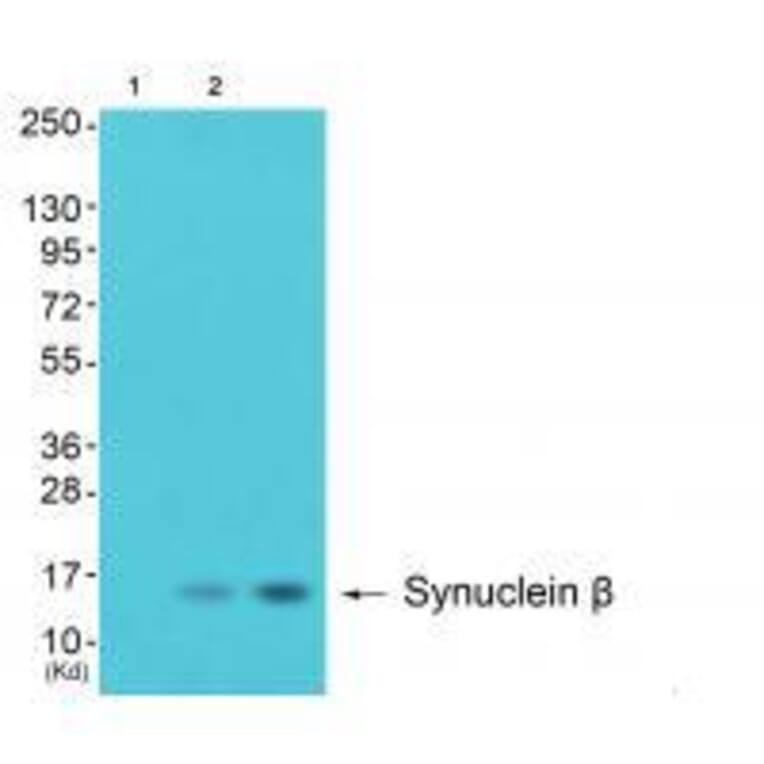 Western blot - Synuclein β Antibody from Signalway Antibody (33494) - Antibodies.com