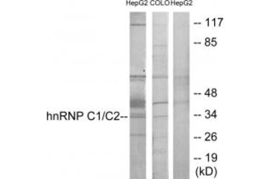 Western blot - hnRNP C1/C2 Antibody from Signalway Antibody (33658) - Antibodies.com