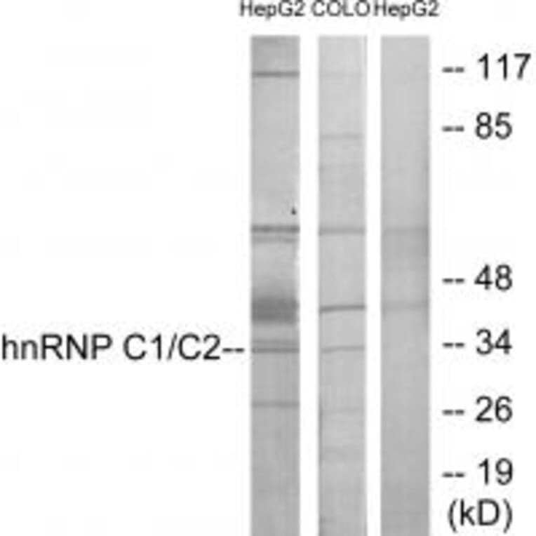 Western blot - hnRNP C1/C2 Antibody from Signalway Antibody (33658) - Antibodies.com