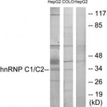 Western blot - hnRNP C1/C2 Antibody from Signalway Antibody (33658) - Antibodies.com