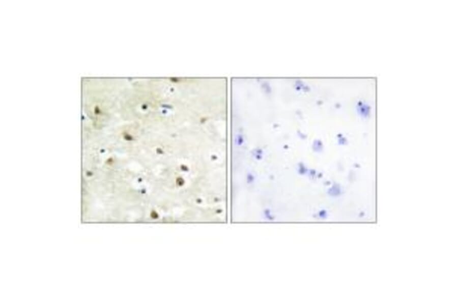 Immunohistochemistry - hnRNP C1/C2 Antibody from Signalway Antibody (33658) - Antibodies.com