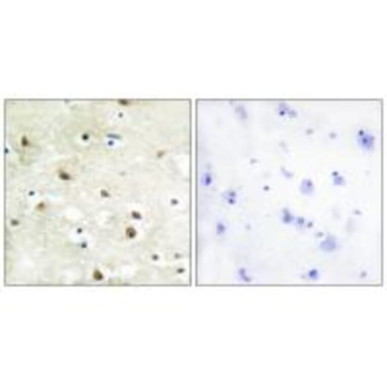 Immunohistochemistry - hnRNP C1/C2 Antibody from Signalway Antibody (33658) - Antibodies.com
