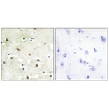Immunohistochemistry - hnRNP C1/C2 Antibody from Signalway Antibody (33658) - Antibodies.com