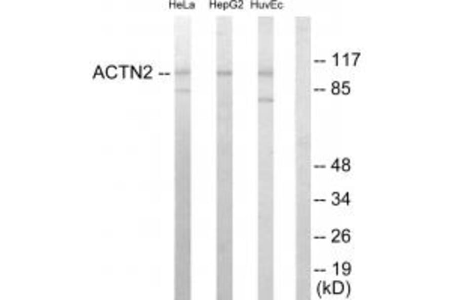 Western blot - Actin α-2/3 Antibody from Signalway Antibody (33759) - Antibodies.com