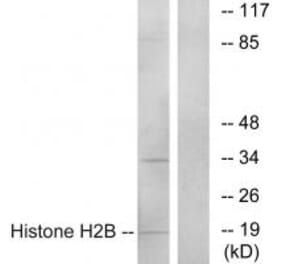 Western blot - Histone H2B Antibody from Signalway Antibody (34015) - Antibodies.com