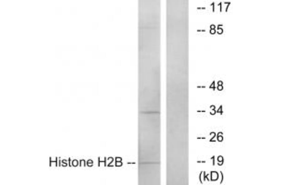 Western blot - Histone H2B Antibody from Signalway Antibody (34015) - Antibodies.com
