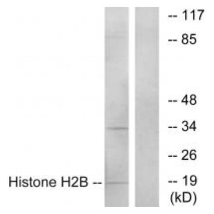 Western blot - Histone H2B Antibody from Signalway Antibody (34015) - Antibodies.com
