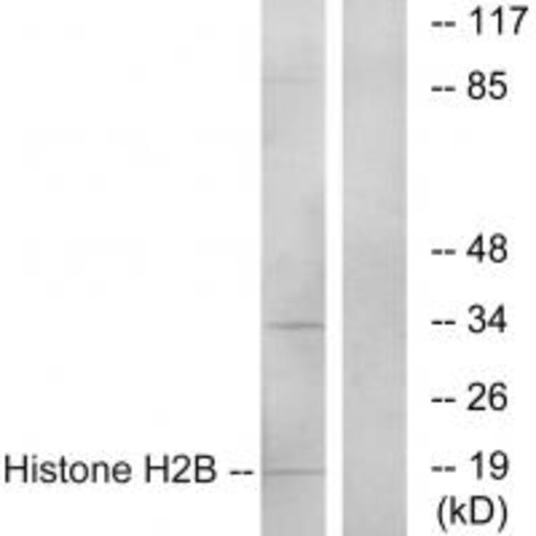 Western blot - Histone H2B Antibody from Signalway Antibody (34015) - Antibodies.com