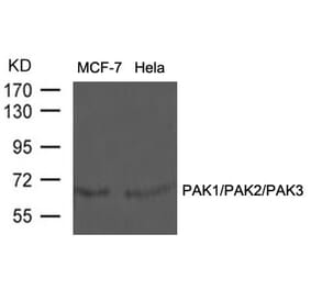 Western blot - PAK1/PAK2/PAK3 (Ab-423/402/421) Antibody from Signalway Antibody (21169) - Antibodies.com