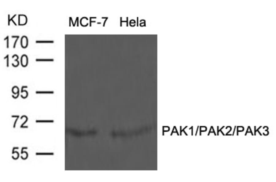 Western blot - PAK1/PAK2/PAK3 (Ab-423/402/421) Antibody from Signalway Antibody (21169) - Antibodies.com