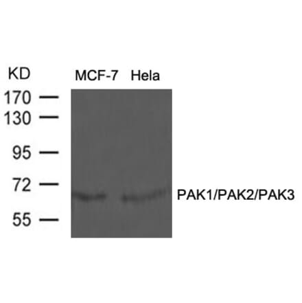 Western blot - PAK1/PAK2/PAK3 (Ab-423/402/421) Antibody from Signalway Antibody (21169) - Antibodies.com