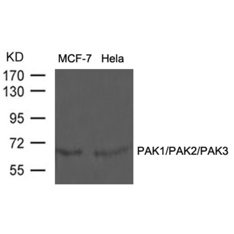 Western blot - PAK1/PAK2/PAK3 (Ab-423/402/421) Antibody from Signalway Antibody (21169) - Antibodies.com