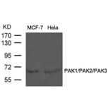 Western blot - PAK1/PAK2/PAK3 (Ab-423/402/421) Antibody from Signalway Antibody (21169) - Antibodies.com