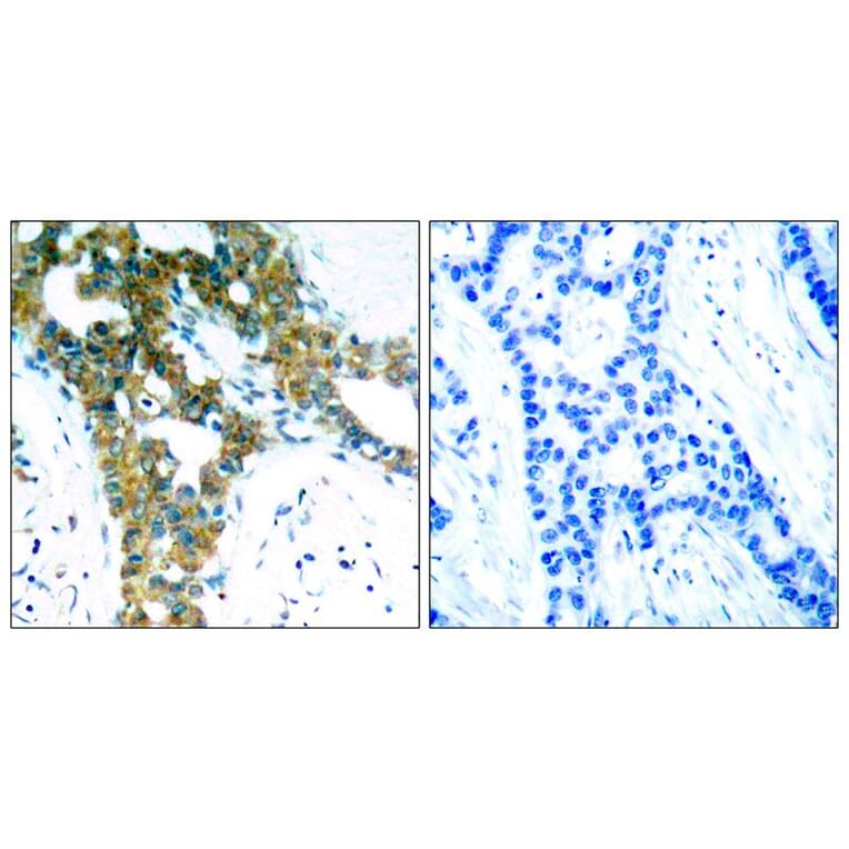 Immunohistochemistry - PAK1/PAK2/PAK3 (Ab-423/402/421) Antibody from Signalway Antibody (21169) - Antibodies.com