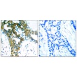 Immunohistochemistry - PAK1/PAK2/PAK3 (Ab-423/402/421) Antibody from Signalway Antibody (21169) - Antibodies.com