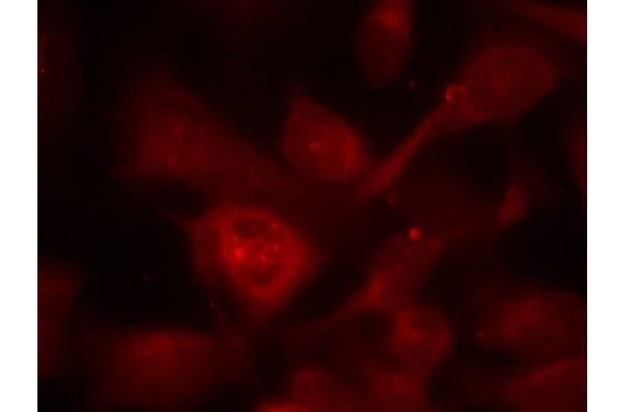 Immunofluorescence - PAK1/PAK2/PAK3 (Ab-423/402/421) Antibody from Signalway Antibody (21169) - Antibodies.com