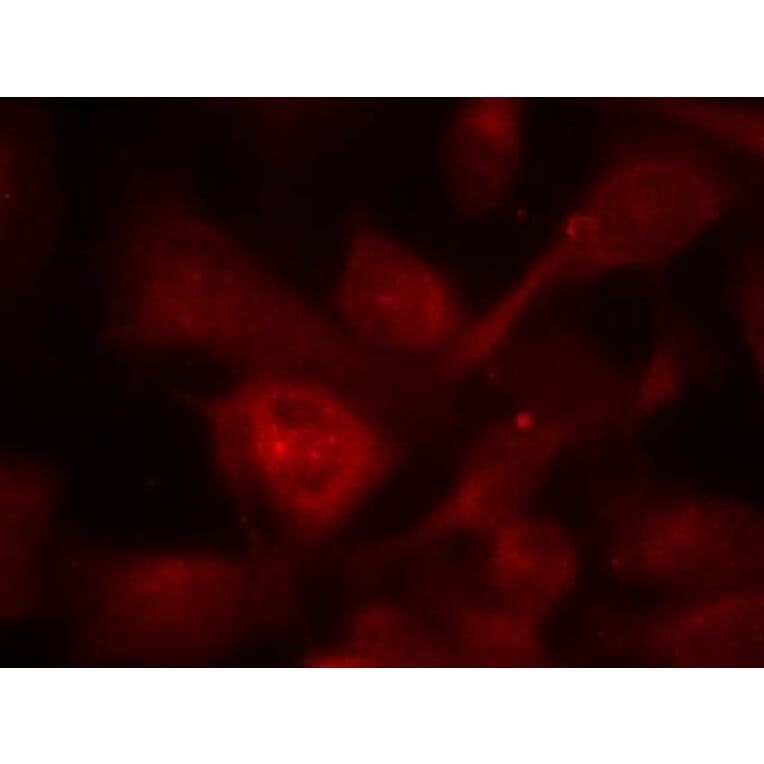 Immunofluorescence - PAK1/PAK2/PAK3 (Ab-423/402/421) Antibody from Signalway Antibody (21169) - Antibodies.com