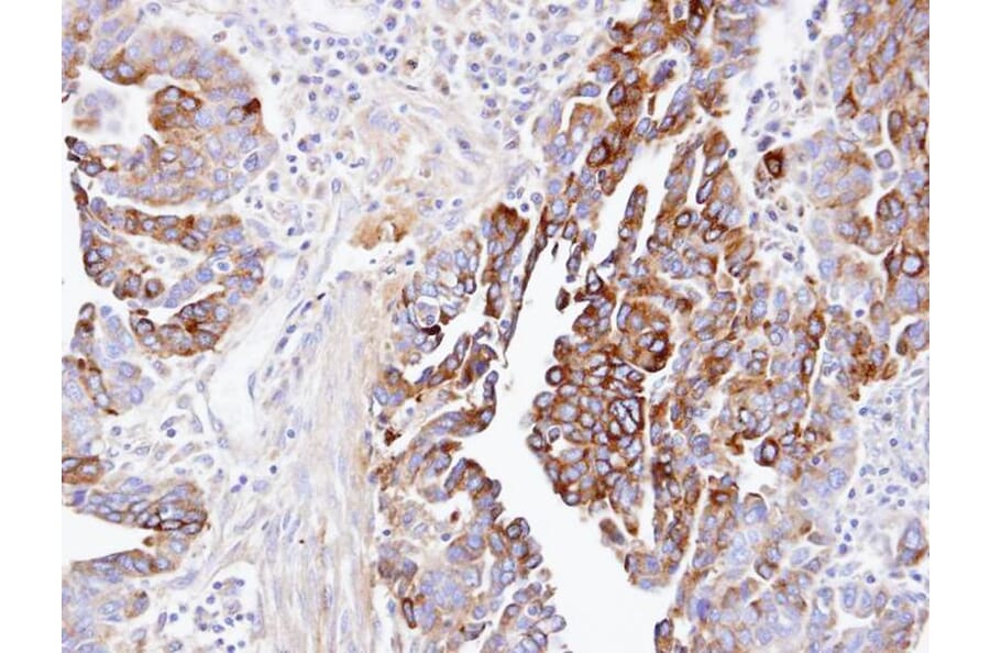 Immunohistochemistry - dynactin 1 antibody from Signalway Antibody (22058) - Antibodies.com