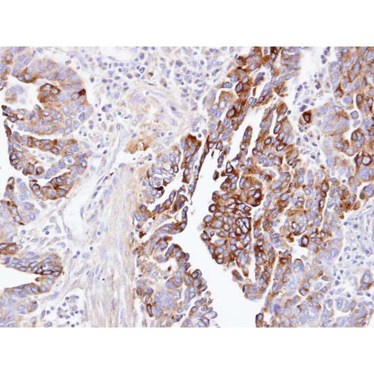 Immunohistochemistry - dynactin 1 antibody from Signalway Antibody (22058) - Antibodies.com