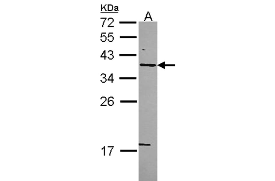 Syntaxin 5 antibody from Signalway Antibody (22277) - Antibodies.com