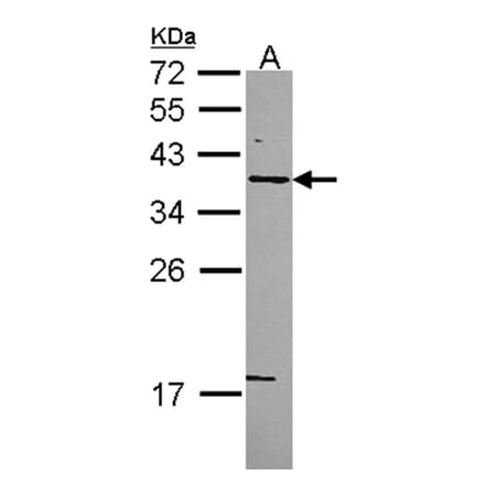 Syntaxin 5 antibody from Signalway Antibody (22277) - Antibodies.com