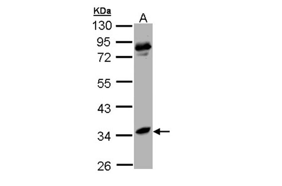arginase I antibody from Signalway Antibody (22279) - Antibodies.com