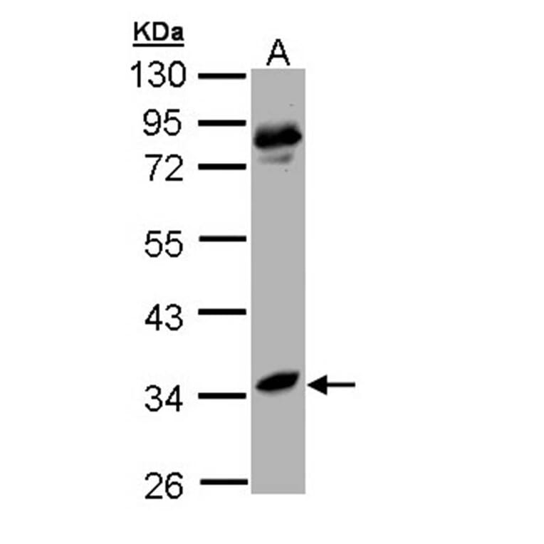 arginase I antibody from Signalway Antibody (22279) - Antibodies.com