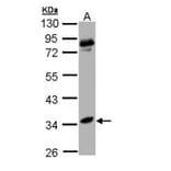 arginase I antibody from Signalway Antibody (22279) - Antibodies.com