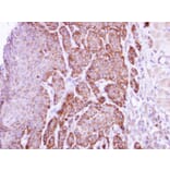 Immunohistochemistry - arginase I antibody from Signalway Antibody (22279) - Antibodies.com
