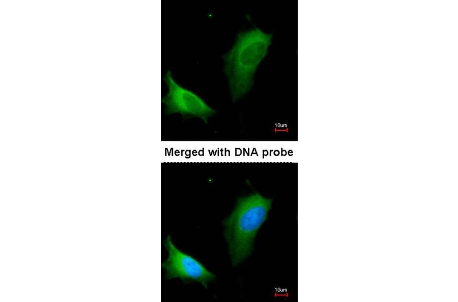 Immunofluorescence - arginase I antibody from Signalway Antibody (22279) - Antibodies.com