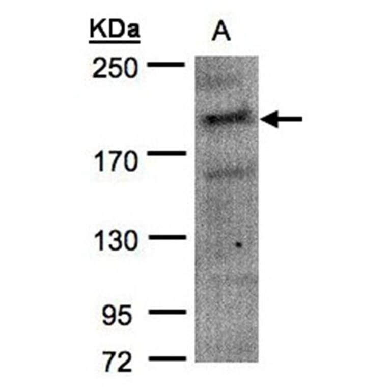 MRCKalpha antibody from Signalway Antibody (22420) - Antibodies.com