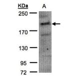 MRCKalpha antibody from Signalway Antibody (22420) - Antibodies.com