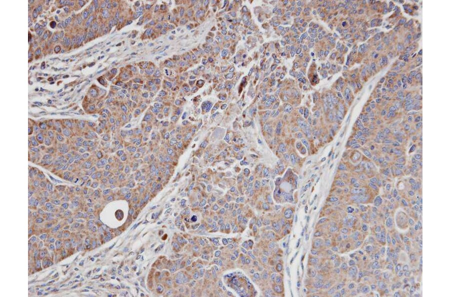 Immunohistochemistry - MRCKalpha antibody from Signalway Antibody (22420) - Antibodies.com