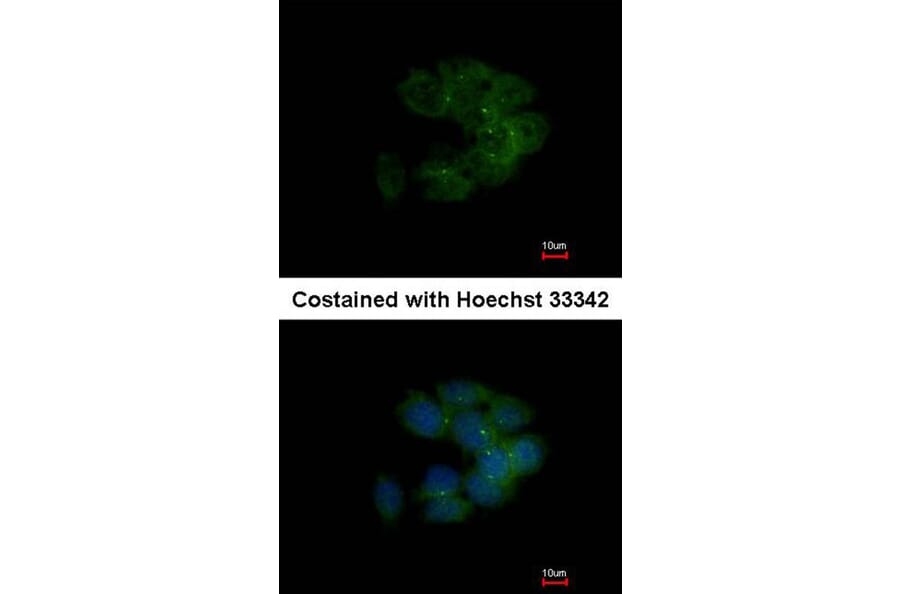 Immunofluorescence - MRCKalpha antibody from Signalway Antibody (22420) - Antibodies.com