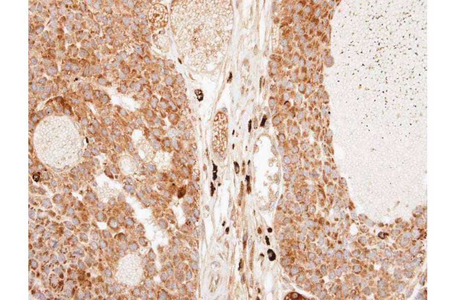 Immunohistochemistry - Importin-7 antibody from Signalway Antibody (22447) - Antibodies.com