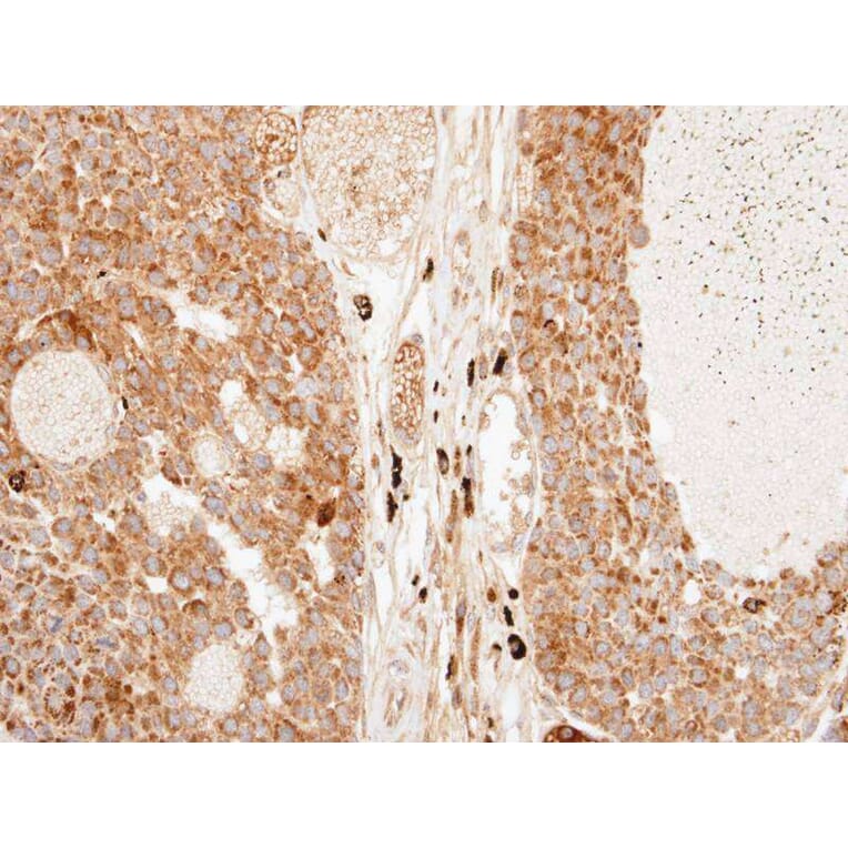 Immunohistochemistry - Importin-7 antibody from Signalway Antibody (22447) - Antibodies.com