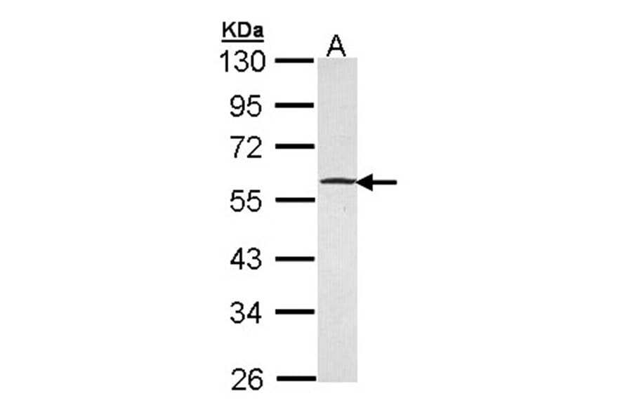 GABP-beta1 antibody from Signalway Antibody (22599) - Antibodies.com