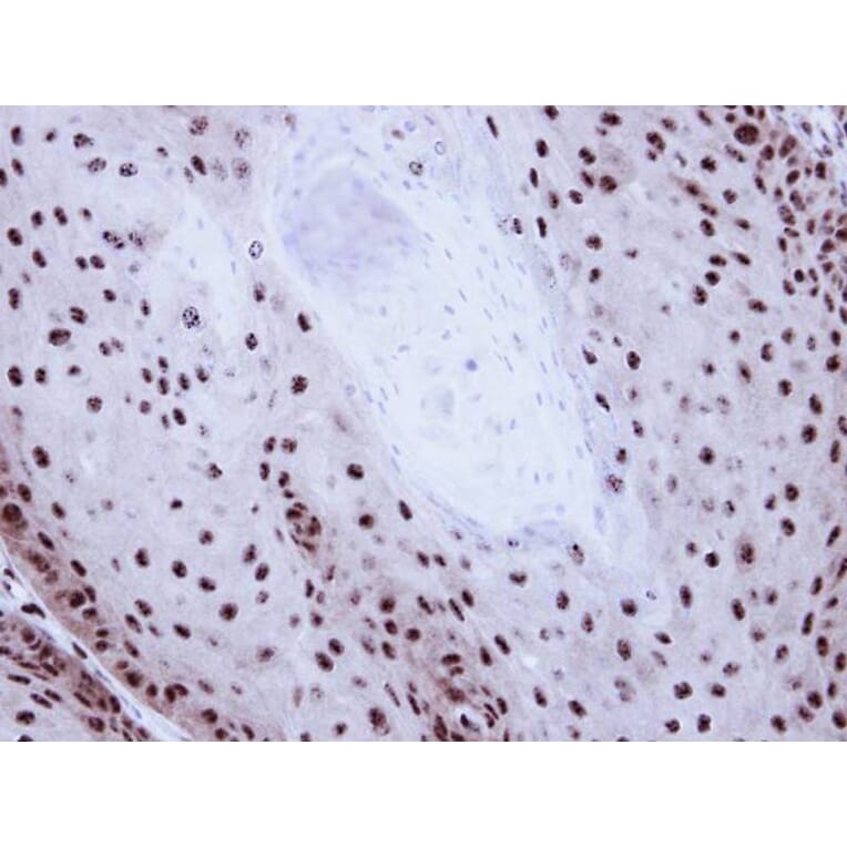 Immunohistochemistry - GABP-beta1 antibody from Signalway Antibody (22599) - Antibodies.com