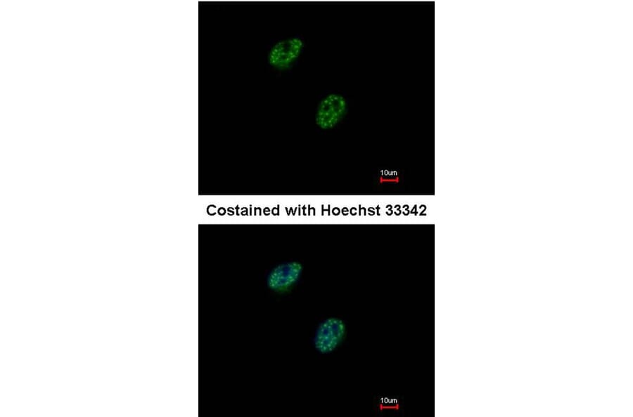 Immunofluorescence - GABP-beta1 antibody from Signalway Antibody (22599) - Antibodies.com