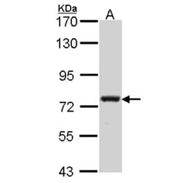 Calpain 5 antibody from Signalway Antibody (22798) - Antibodies.com