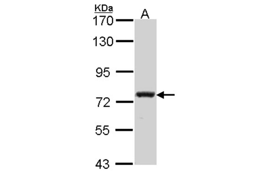 Calpain 5 antibody from Signalway Antibody (22798) - Antibodies.com